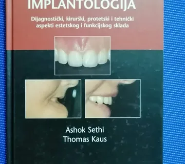 Ashok Sethi i Thomas Kaus – Praktična implantologija - cover
