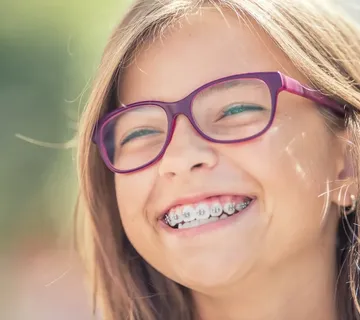 Fiksni aparatić za zube - cover