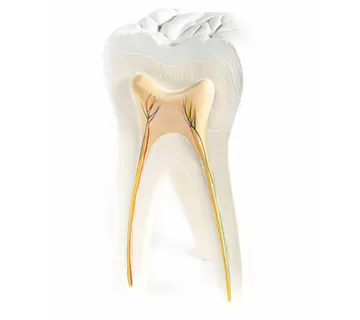 Endodontsko liječenje (endodoncija) zuba - cover