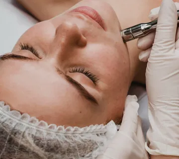 Mezoterapija - cover