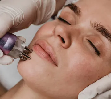 Microneedling - cover