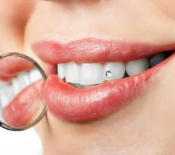 Zubni nakit (cirkoni i ostali skupocjeni ukrasi) - cover