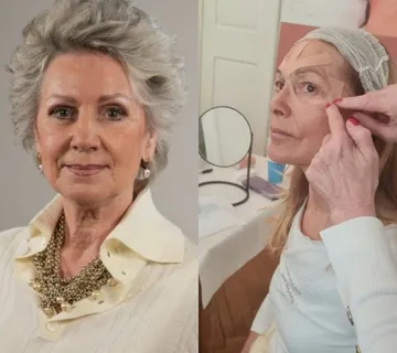 Individualni trening Kineziološke trake - cover