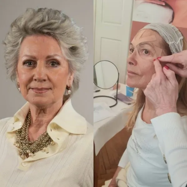 Individualni trening Kineziološke trake - cover