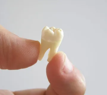 Pečaćenje fisura - cover