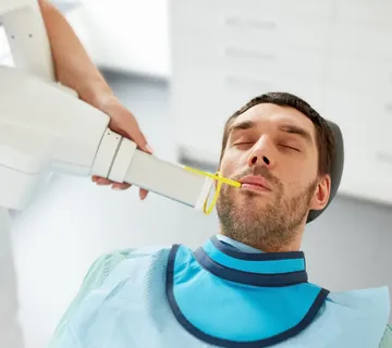 Intraoralna snimka zuba - cover