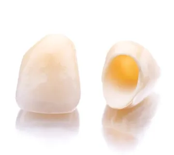 Zubne krunice (navlake za zube) - cover