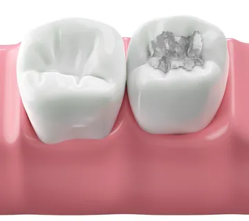 Konzervativa (opća stomatologija) - cover