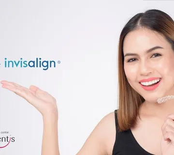 Prozirni (Invisalign) aparatić za zube - cover