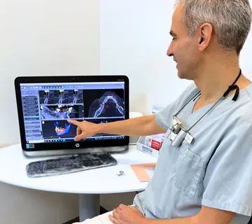 Ugradnja zubnih implantata - cover