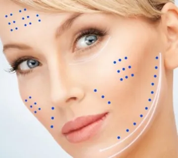 Skinbooster - Zagreb