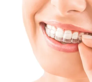 Invisalign - Zagreb