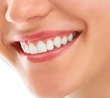 Gingivitis (upala zubnog mesa) - cover