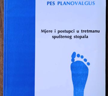 SPUŠTENO STOPALO Mjere i postupci u tretmanu spuštenog Zdenko Kosinac - cover