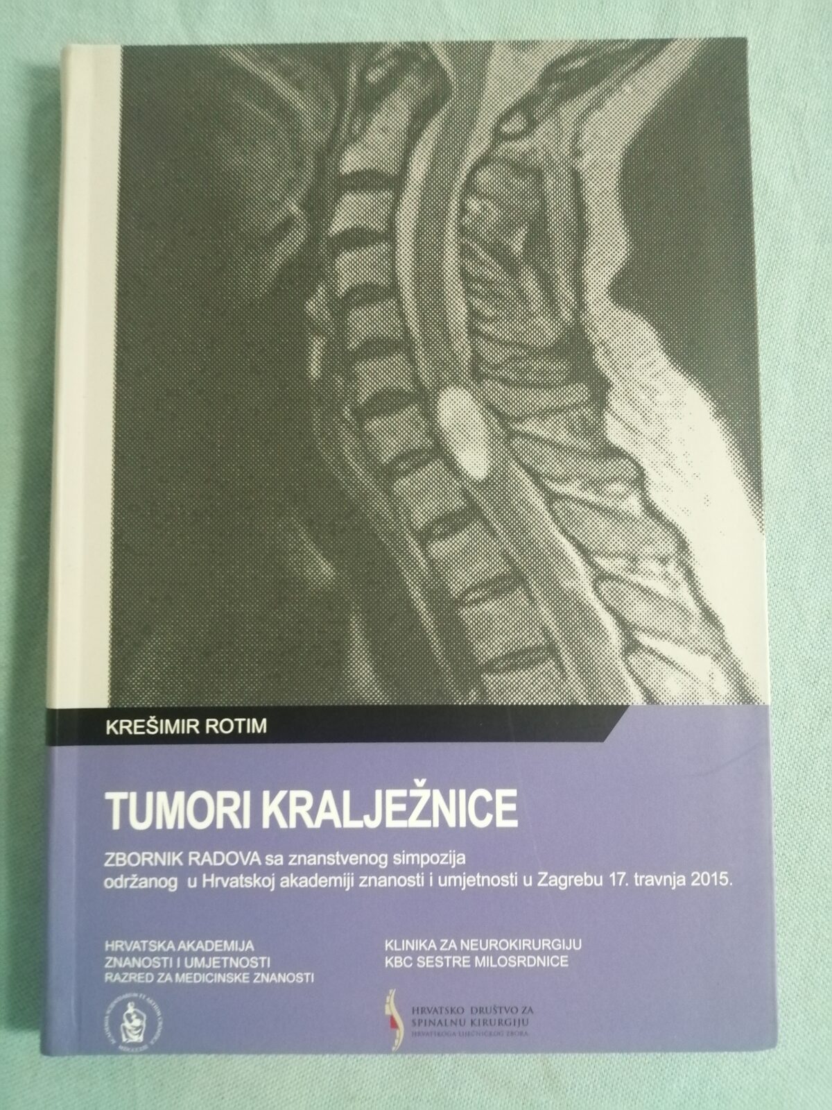 Krešimir Rotim (ur.) – Tumori kralježnice - cover