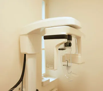 Digitalni ortopan (slikanje) zubi - cover