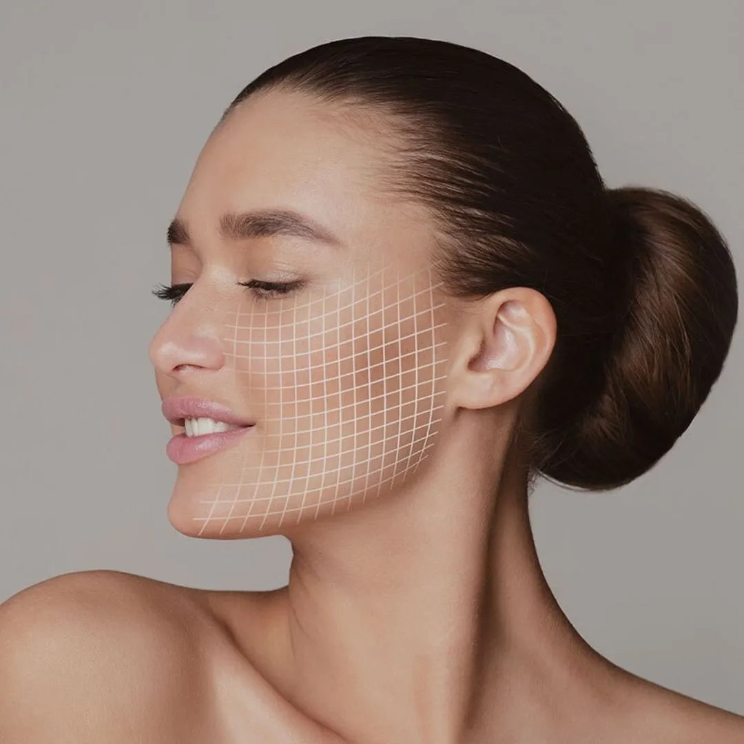 microneedling – skinpen - slika 2