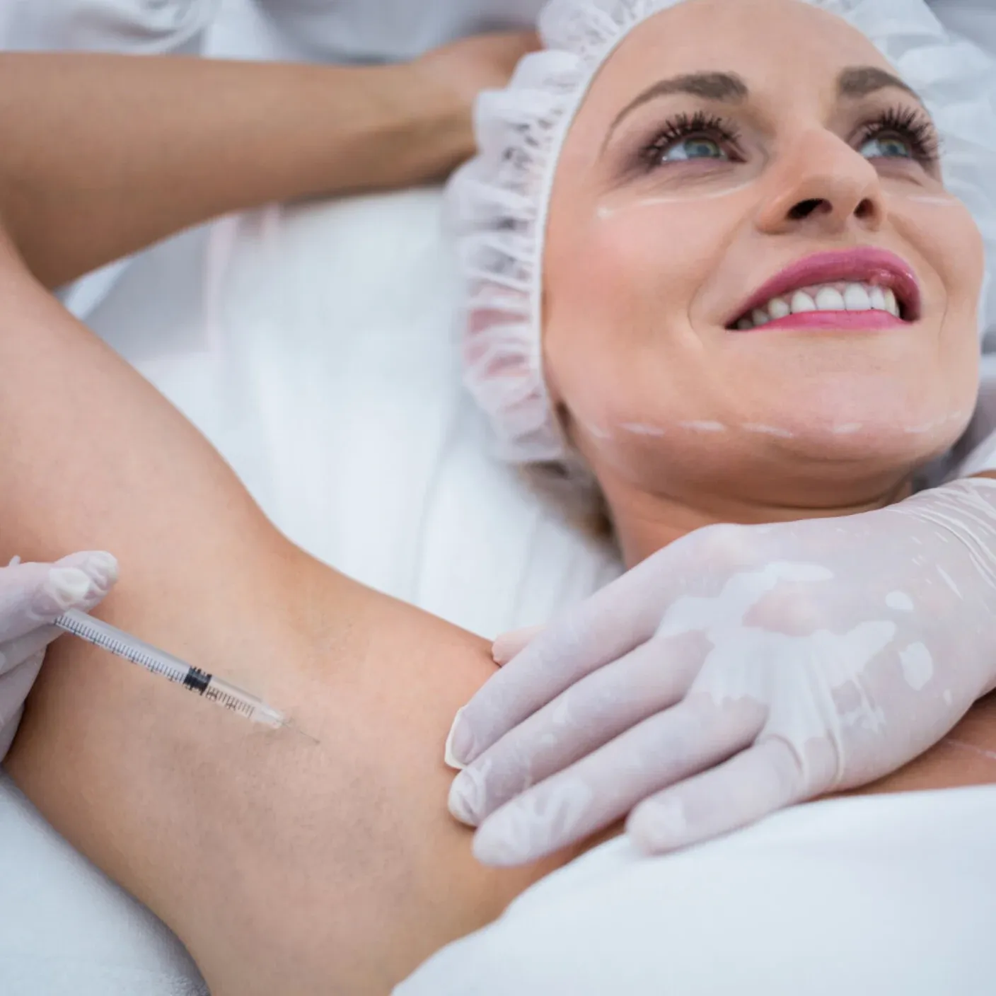 Botox protiv znojenja (do 50 jedinica) - Zagreb