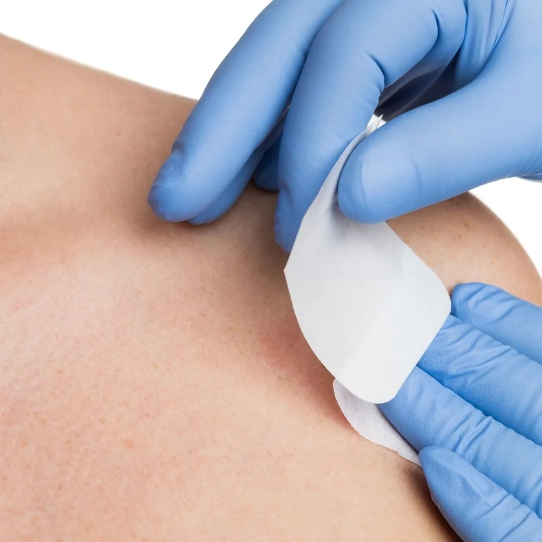 dermatokirurgija - slika 1