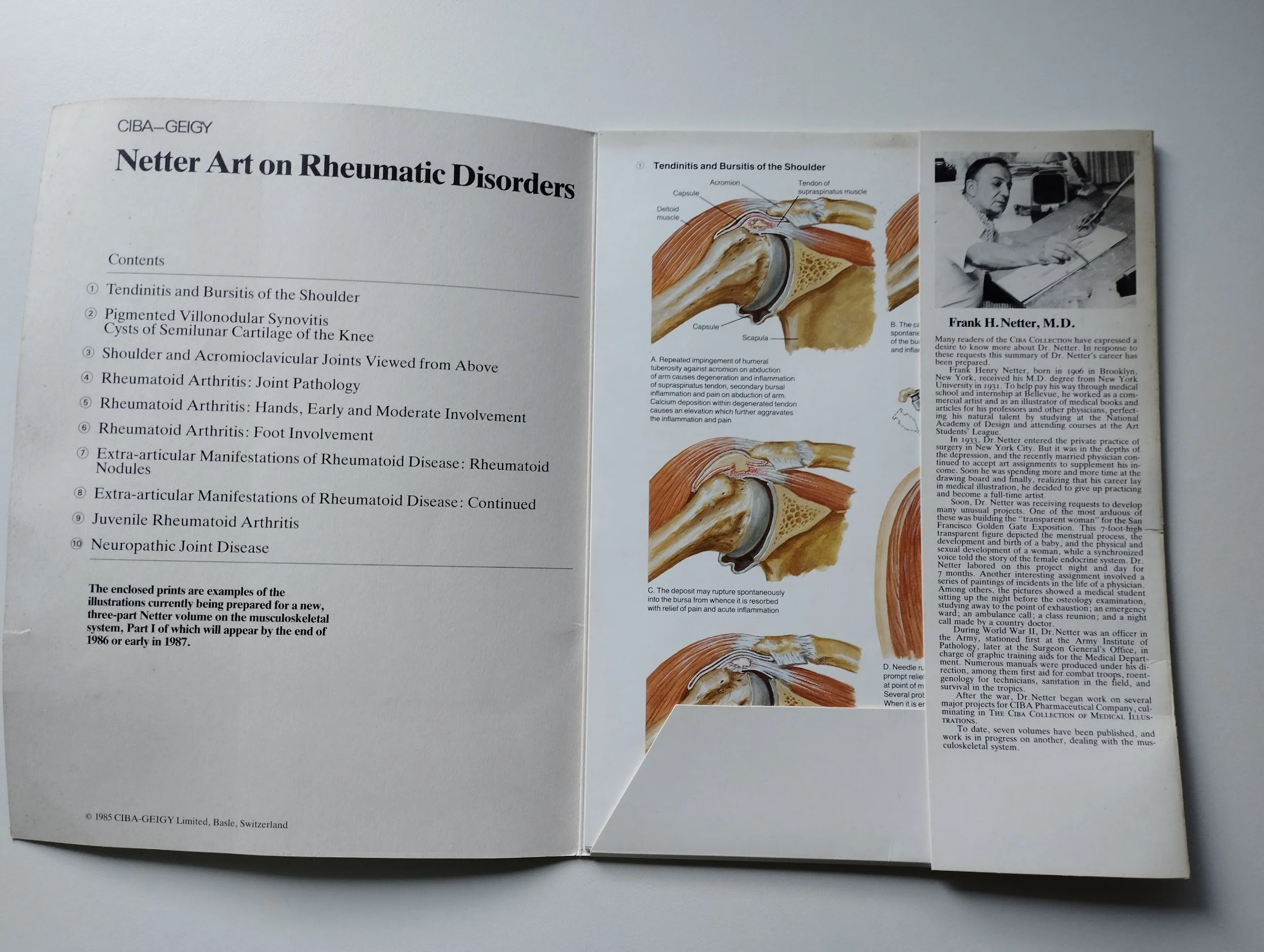 frank h netter, m.d. - netter art on rheumatic disorders - slika 3