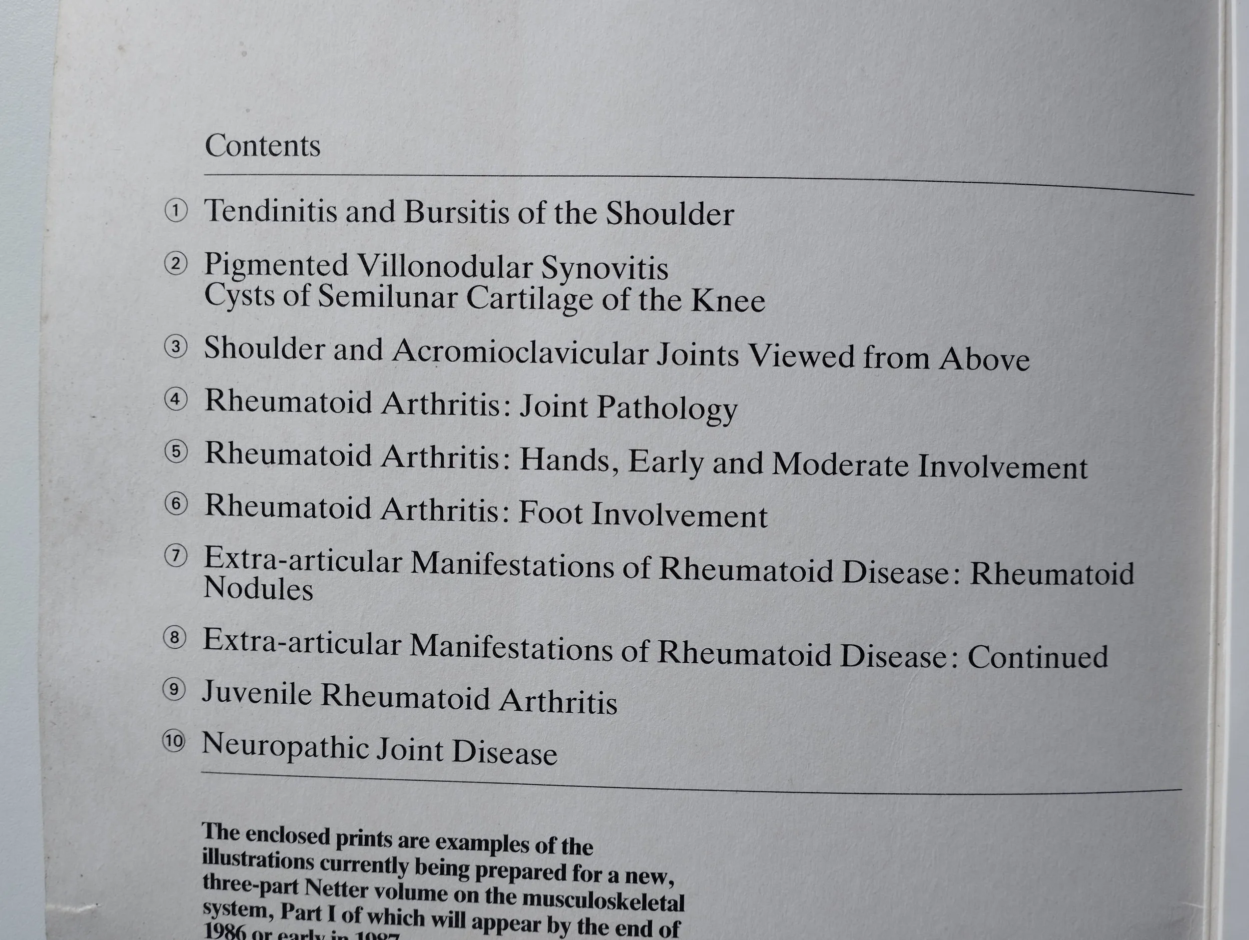 frank h netter, m.d. - netter art on rheumatic disorders - slika 4