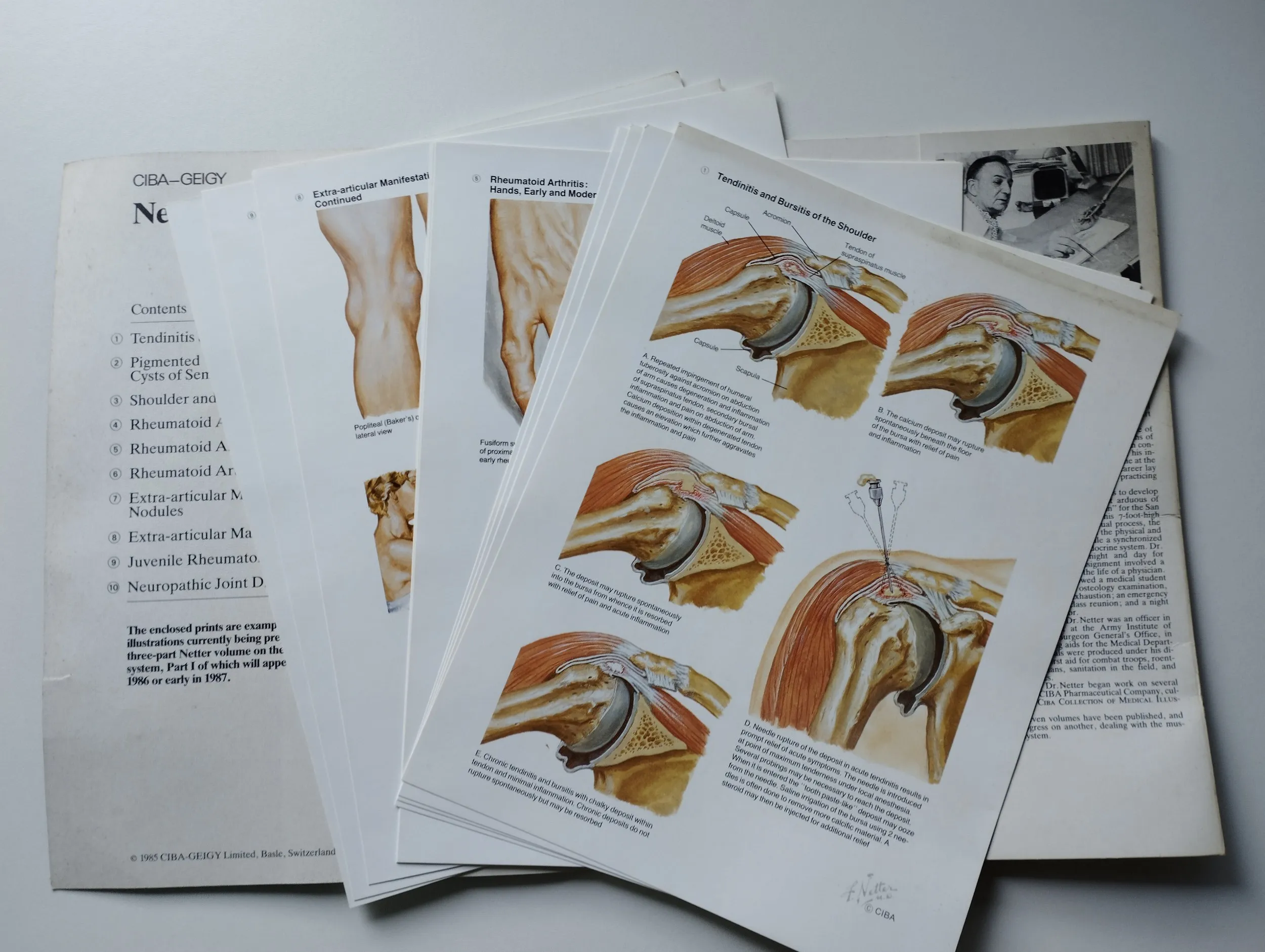 frank h netter, m.d. - netter art on rheumatic disorders - slika 5