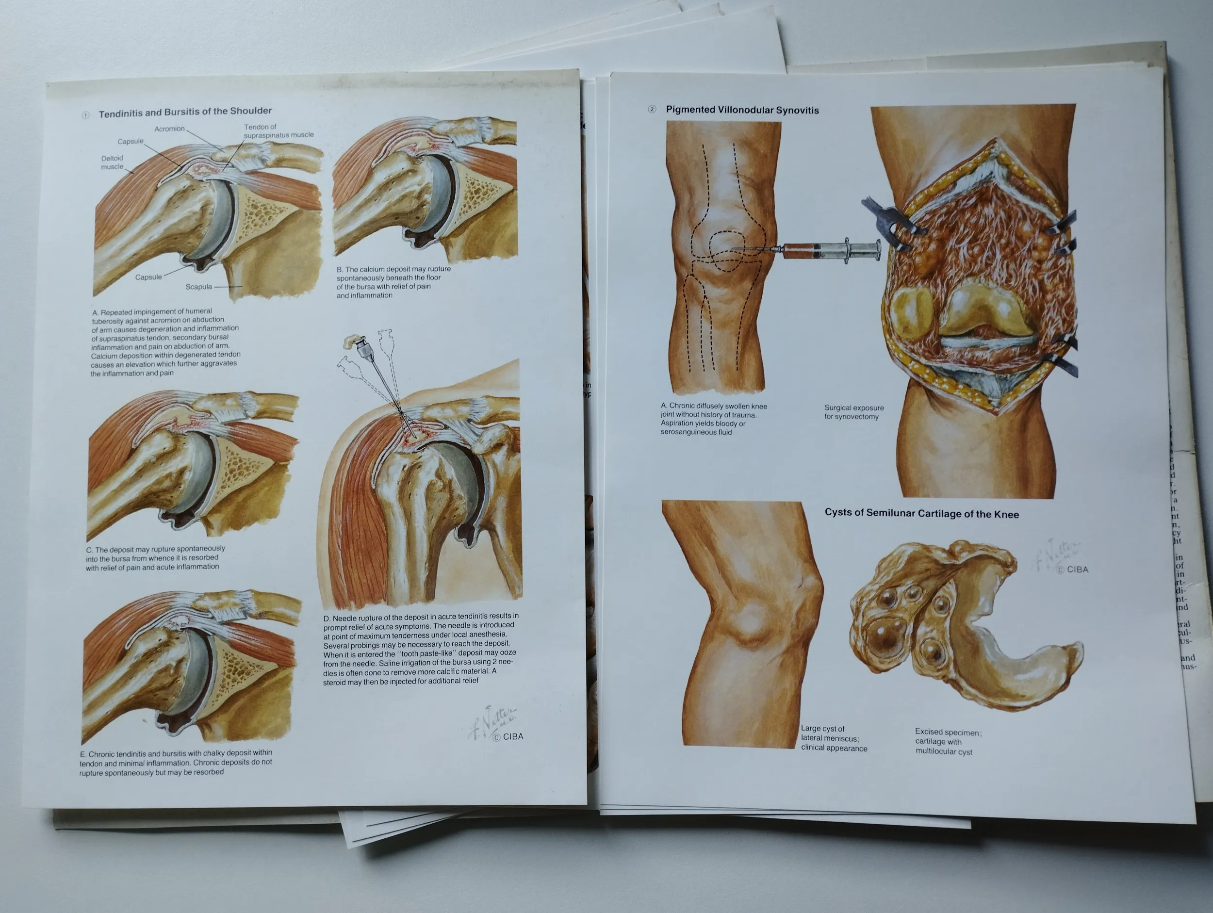 frank h netter, m.d. - netter art on rheumatic disorders - slika 6
