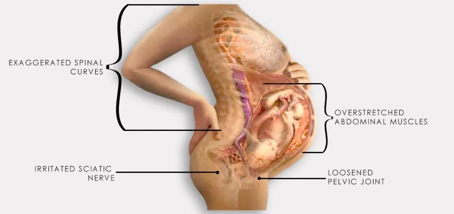 medicinski pojas za trudnice i majke nakon poroda reh4mat am-pcs-01 - slika 6