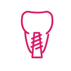 održavanje i higijena nakon ugradnje implantata - slika 2