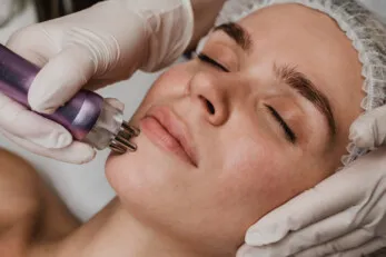 Microneedling + skinbooster - Zagreb