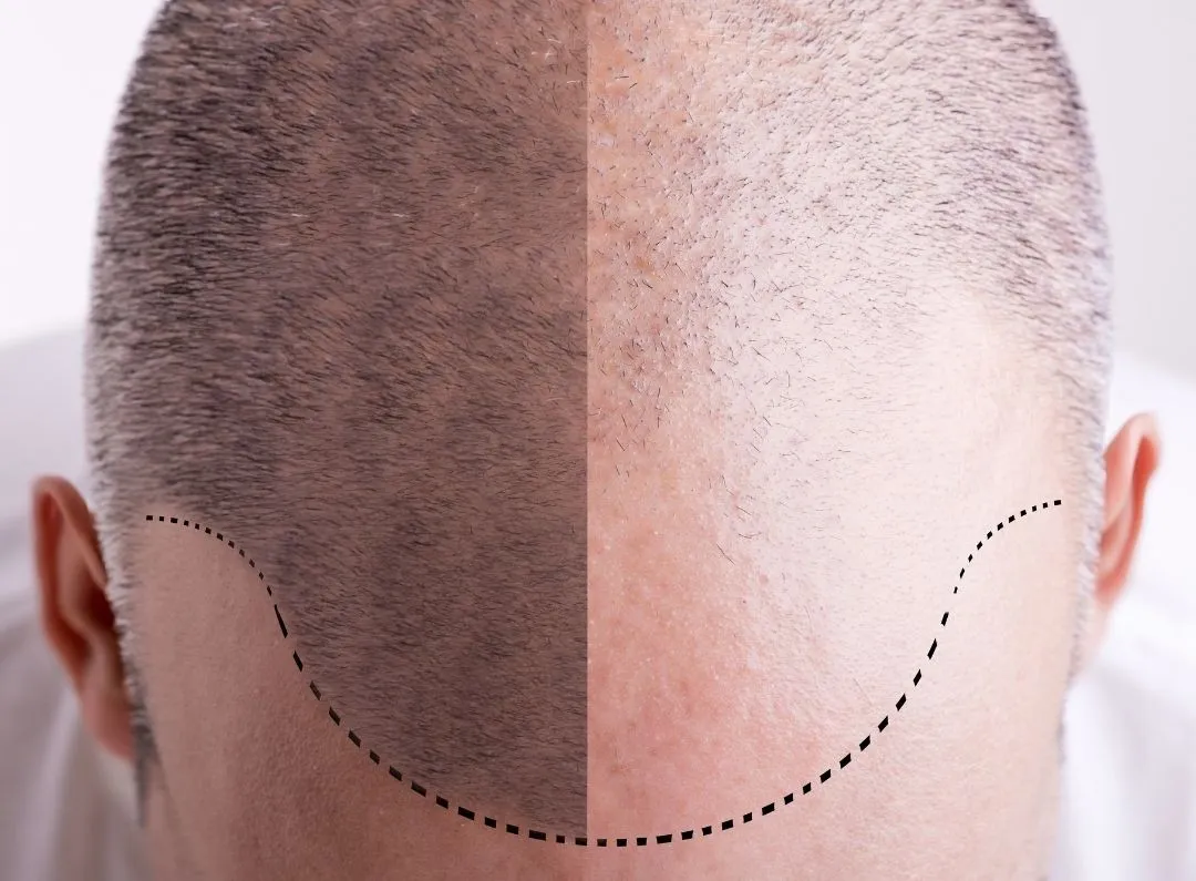 trichogen test - slika 1