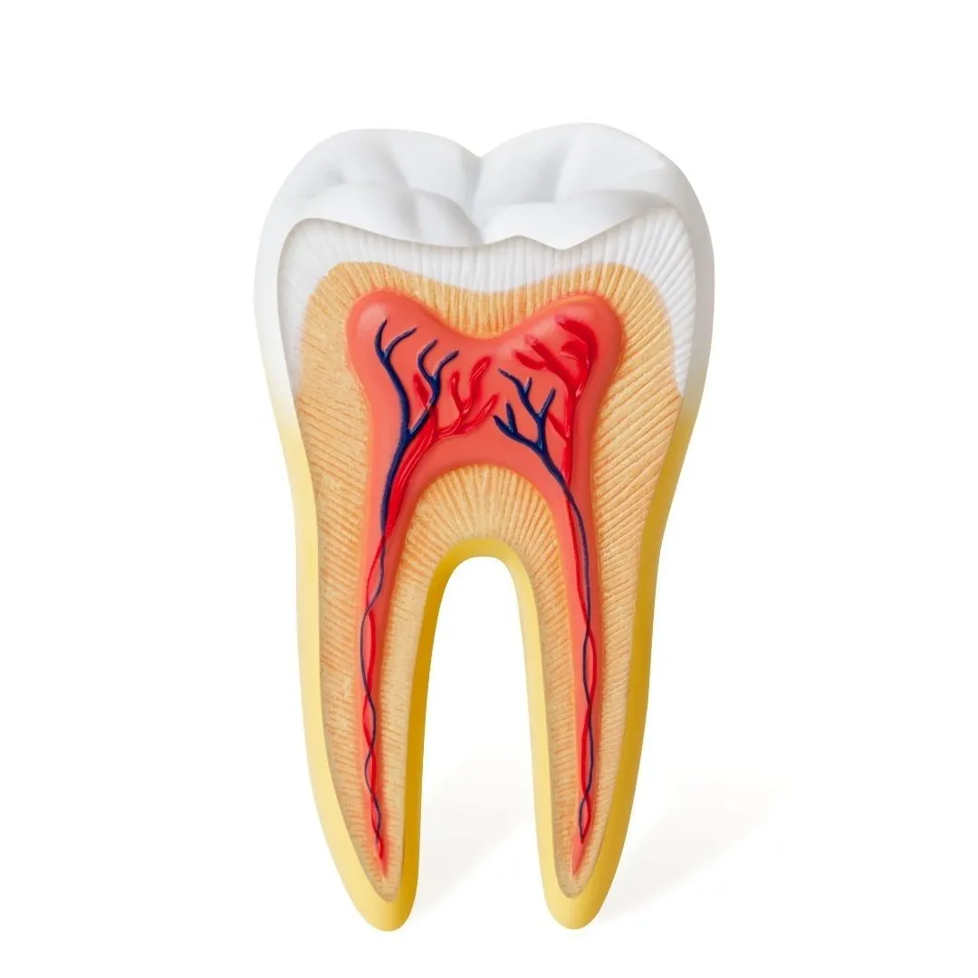 liječenje zuba – endodoncija - slika 2